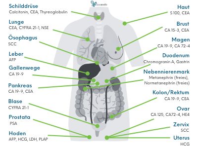 Übersicht der jeweiligen Tumormarker für die Entsprechenden Organe.