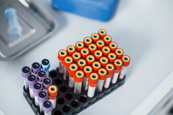 Molekulargenetische Untersuchungen sind ein wichtiges Instrument für die Behandlungsentscheidung bei NSCLC