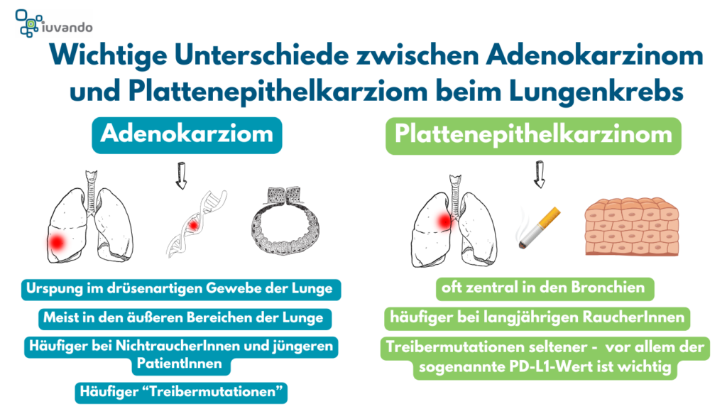 Schematische Aufführung der Unterschiede zwischen Adenokarzinom und Plattenepithelkarzinom beim Lungenkrebs